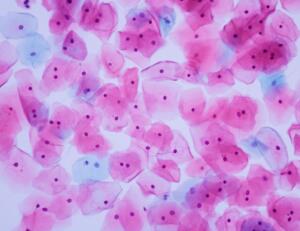 Livmorhalscelle Original 795067126