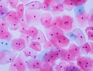 Livmorhalscelle Rendered